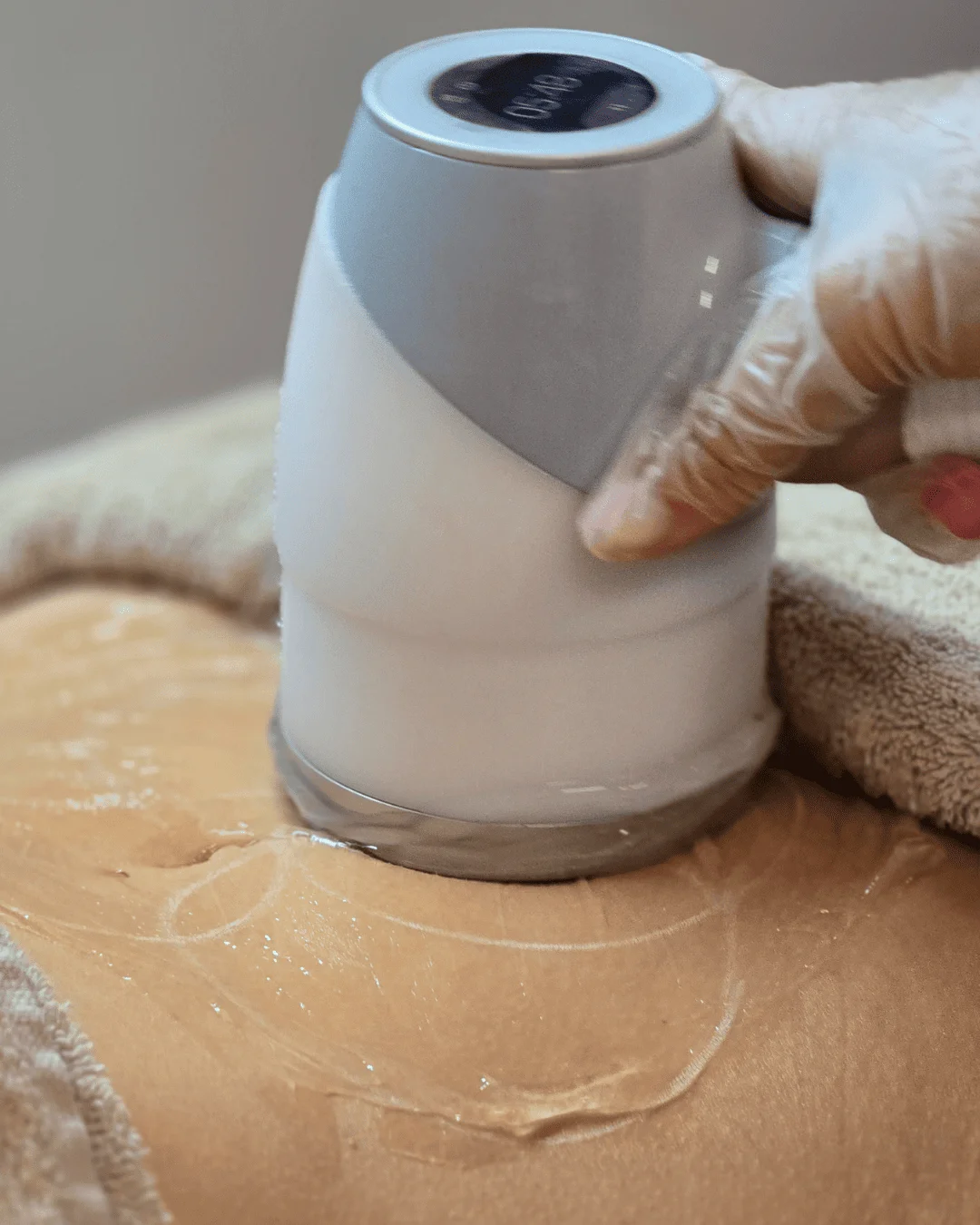 Tratamento Criofrequência Corporal