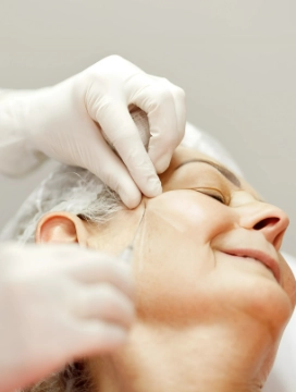 Tratamento Bioestimulador de Colagénio